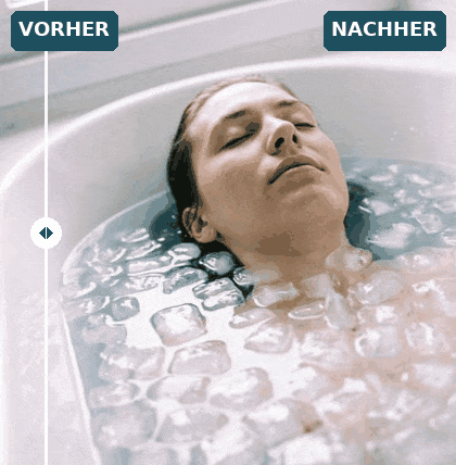 Vorher-Nachher-Vergleich des Magnific-Upscalers: links Before, rechts After